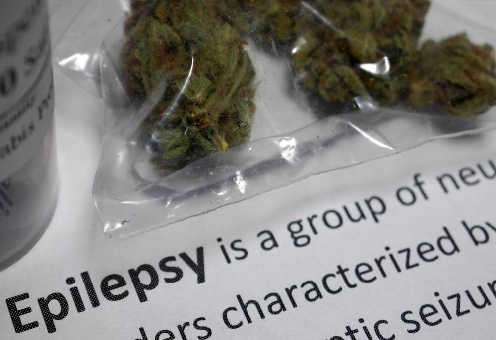 cannabis epilepsy management